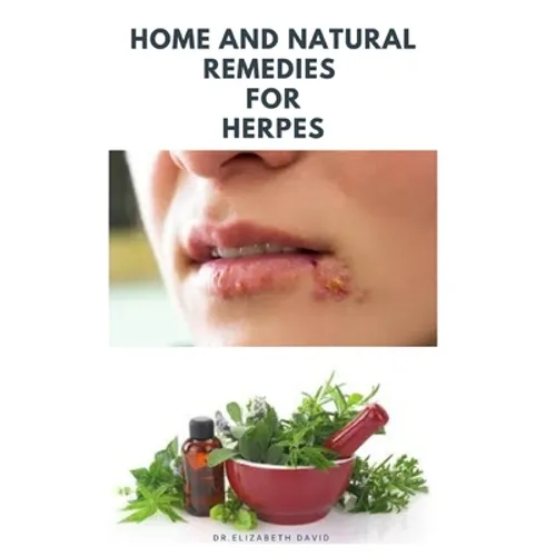 Home and Natural Remedies for Herpes: The Best Herbal And Natural Remedies To Get Rid Of All Form Of Herpes Virus