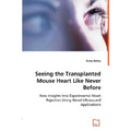 Seeing the Transplanted Mouse Heart Like Never Before