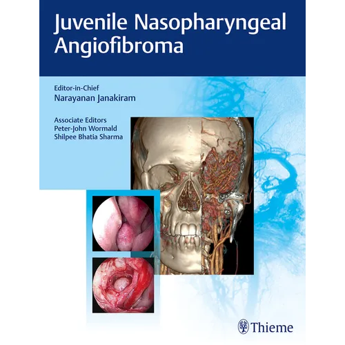 Juvenile Nasopharyngeal Angiofibroma