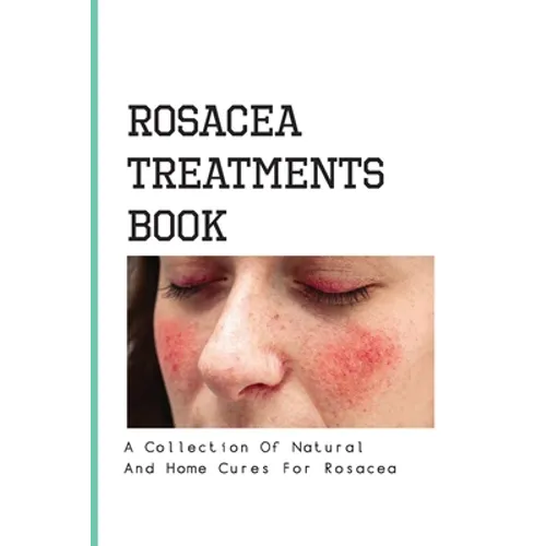 Rosacea Treatments Book- A Collection Of Natural And Home Cures For Rosacea: Rosacea Treatment