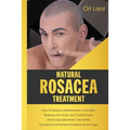 Natural Rosacea Treatment: How to Reduce Inflammation in the Skin, Balance the body and Control Face and Scalp Seborrheic Dermatitis, Dandruff an