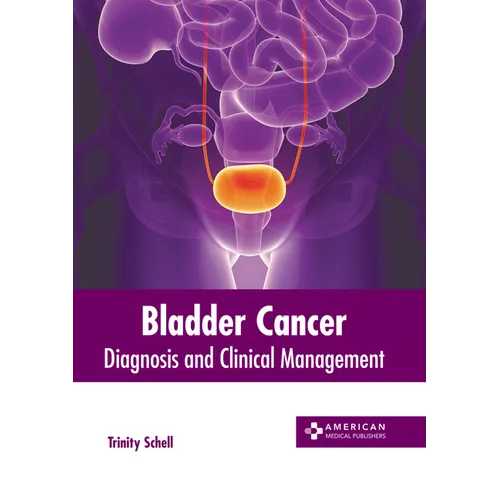Bladder Cancer: Diagnosis and Clinical Management