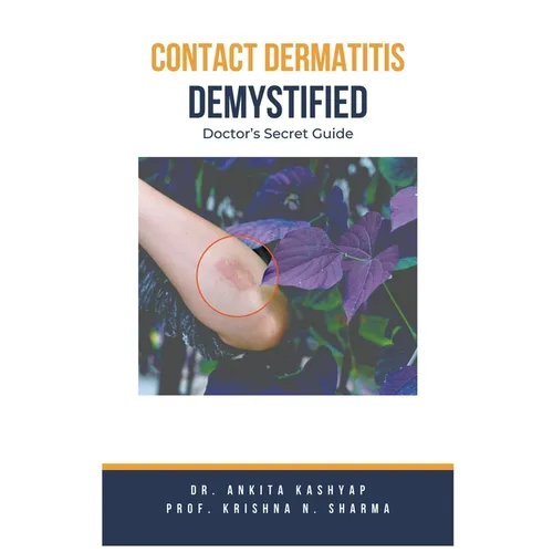 Contact Dermatitis Demystified: Doctor's Secret Guide