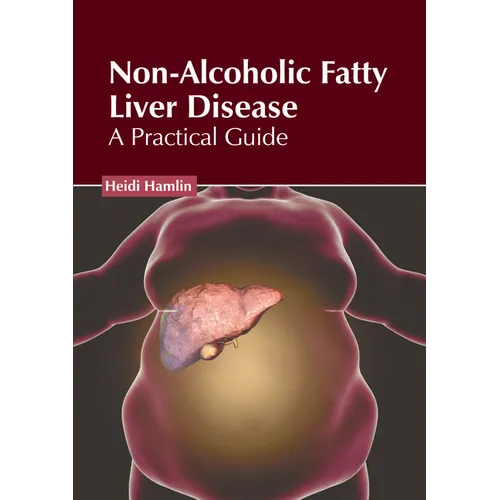 Non-Alcoholic Fatty Liver Disease: A Practical Guide