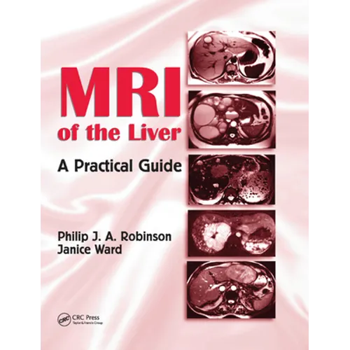 MRI of the Liver: A Practical Guide