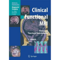 Clinical Functional MRI: Presurgical Functional Neuroimaging