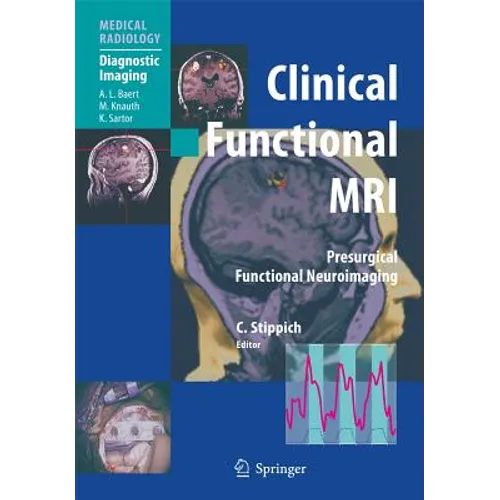 Clinical Functional MRI: Presurgical Functional Neuroimaging