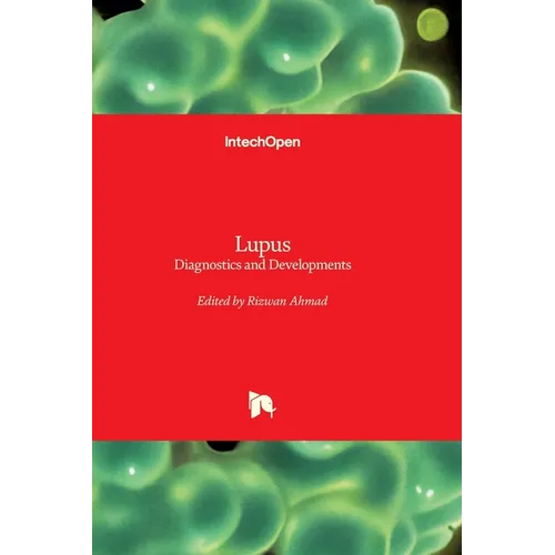 Lupus - Diagnostics and Developments: Diagnostics and Developments
