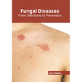 Fungal Diseases: From Infections to Prevention