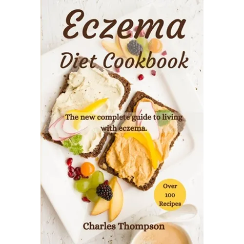 Eczema Diet Cookbook: The new complete guide to living with eczema. More than 100 recipes against the symptoms of dermatitis and psoriasis.