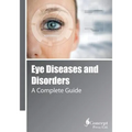 Eye Diseases and Disorders: A Complete Guide