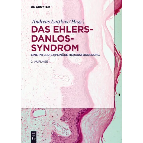 Das Ehlers-Danlos-Syndrom: Eine Interdisziplinäre Herausforderung