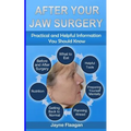 After Your Jaw Surgery: Practical and Helpful Information You Should Know