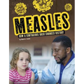 Measles: How a Contagious Rash Changed History