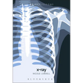 X-Ray