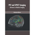 Pet and Spect Imaging: Advances in Medical Imaging