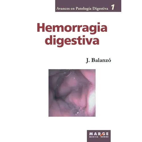 Hemorragia digestiva