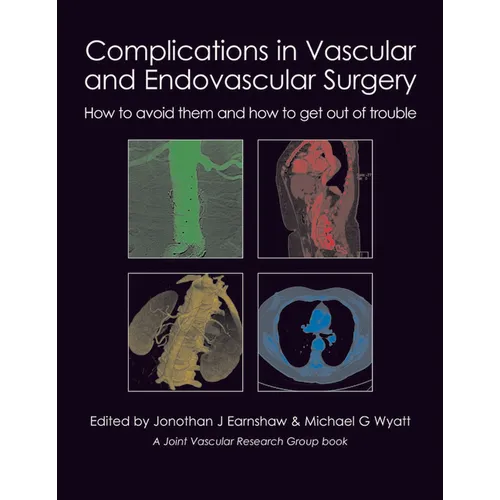 Complications in Vascular and Endovascular Surgery: How to Avoid Them and How to Get Out of Trouble