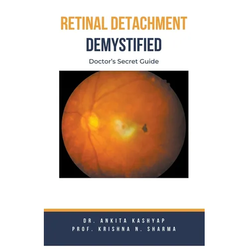 Retinal Detachment Demystified: Doctor's Secret Guide