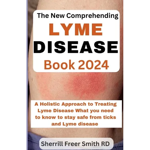 The New Comprehending Lyme Disease Book 2024: A Holistic Approach to Treating Lyme Disease What you need to know to stay safe from ticks and Lyme dise