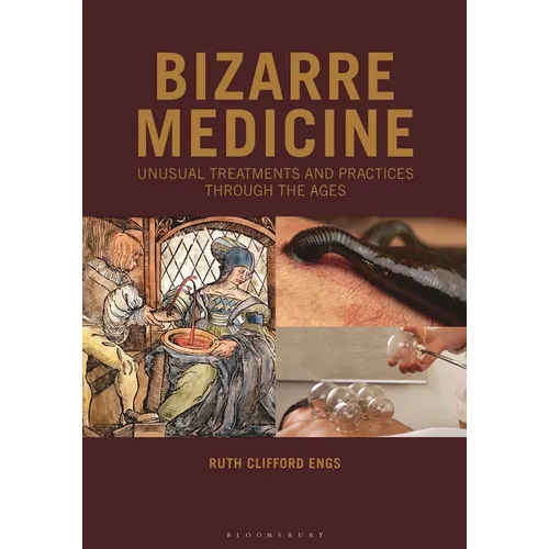 Bizarre Medicine: Unusual Treatments and Practices through the Ages
