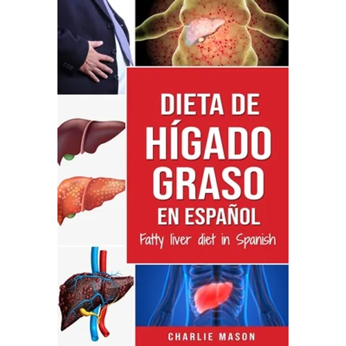Dieta de hígado graso en español/Fatty liver diet in Spanish
