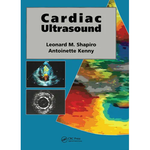 Cardiac Ultrasound