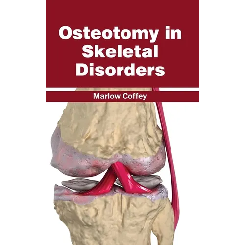 Osteotomy in Skeletal Disorders