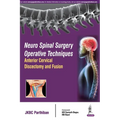 Neuro Spinal Surgery Operative Techniques Anterior Cervical Discectomy and Fusion