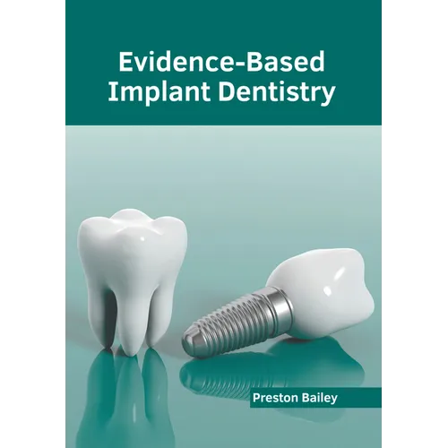 Evidence-Based Implant Dentistry
