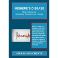 MENIERE'S DISEASE - What is Meniere's, Symptoms, Treatment, and Lifestyle