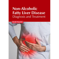 Non-Alcoholic Fatty Liver Disease: Diagnosis and Treatment