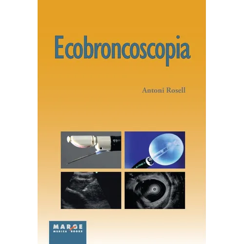 Ecobroncoscopia
