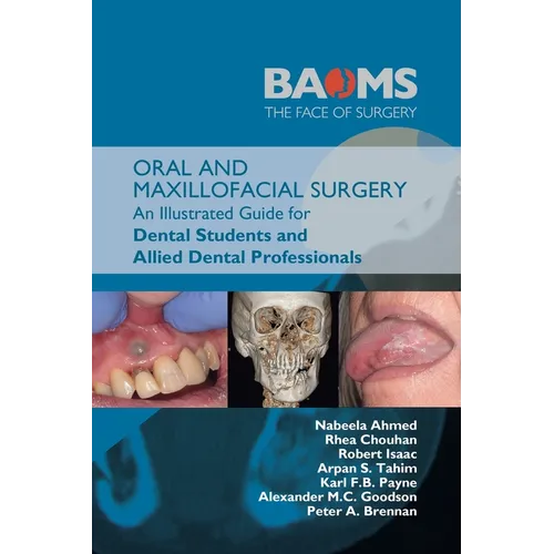 Oral and Maxillofacial Surgery: An Illustrated Guide for Dental Students and Allied Dental Professionals - Paperback