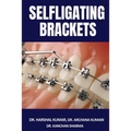 Selfligating Brackets