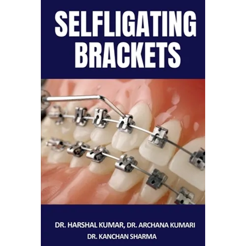 Selfligating Brackets