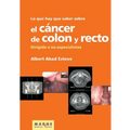 Lo que hay que saber sobre el cáncer de colon y recto