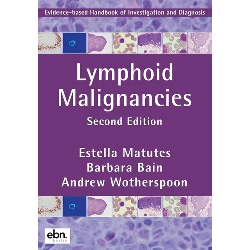 Lymphoid Malignancies