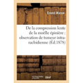 de la Compression Lente de la Moëlle Épinière:: Observation de Tumeur Intra-Rachidienne de la Quatrième Paire Cervicale Gauche