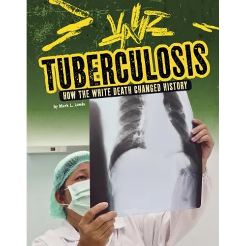 Tuberculosis: How the White Death Changed History