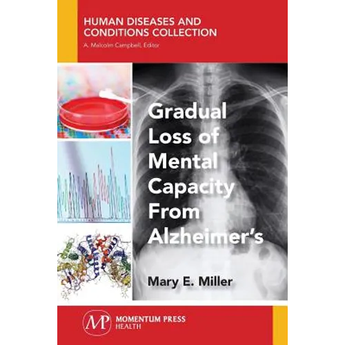 Gradual Loss of Mental Capacity from Alzheimer's