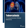 Tuberculosis: A Comprehensive Clinical Reference