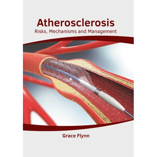 Atherosclerosis: Risks, Mechanisms and Management