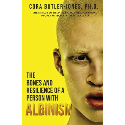 The Bones and Resilience of a Person with Albinism
