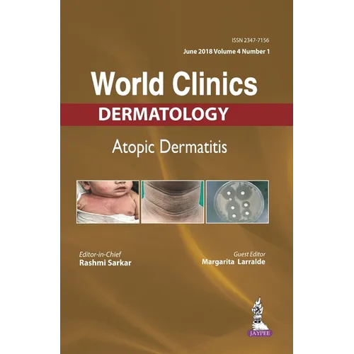 World Clinics-Atopic Dermatitis (June 2018, Vol.04 Issue 1)