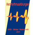 Herzrhythmusstörungen: EKG - Bilder Raten mit Jörn
