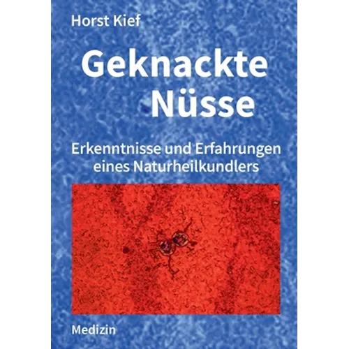 Geknackte Nüsse: Erkenntnisse und Erfahrungen eines Naturheilkundlers
