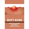 Butt Acne: Home And Natural Treatments For Folliculitis: Barber'S Itch Home Remedies