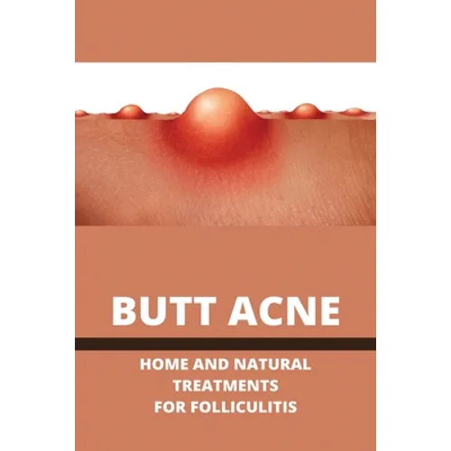 Butt Acne: Home And Natural Treatments For Folliculitis: Barber'S Itch Home Remedies