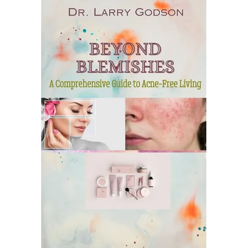 Beyond Blemishes: A Comprehensive Guide to Acne-Free Living/ Skincare Bible for Radiant Skin